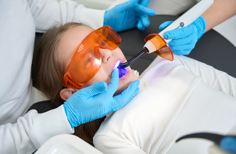Dental Fillings for kids in Norwalk CA