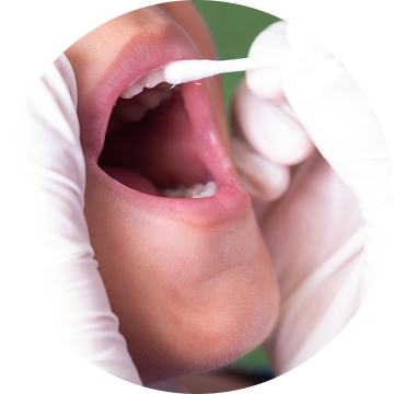 Fluoride Treatment